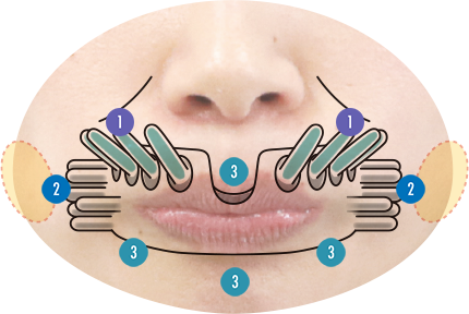 サライバガードのポイント説明図