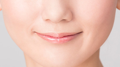 ほうれい線イメージ